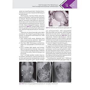 pediatritrehabilitasyonbaski_04.jpg