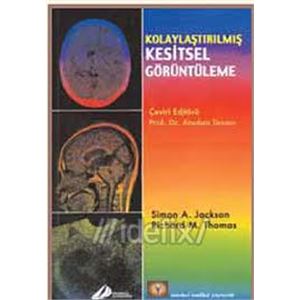 kolaylastirilmis-kesitsel-goruntuleme-atadan-tunaci-imy1326d40f66d1ac8f1c7f5736552bfc0e.jpg