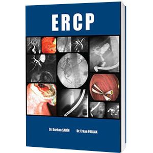 ercp-burhan-sahin-erkan-parlakc4eb5afc1a2da3d59f0e685646883c80.jpg