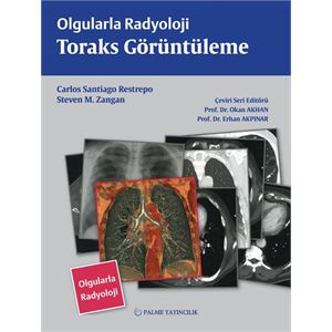 palme-olgularla-radyoloji-toraks-goruntuleme84f58ee3fdbff9d79e1fd7f129d8cc7c.jpg