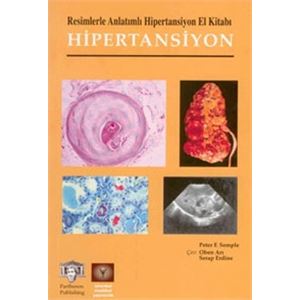 hipertansiyon-el-kitabi36d6a629b262b3cd2fe4e8ff00ed64cb.jpg