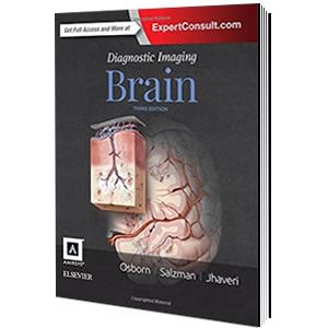 elsevier-diagnostic-imaging-brain08b70d918ad4b52eb17a12dd0c4924b3.jpg