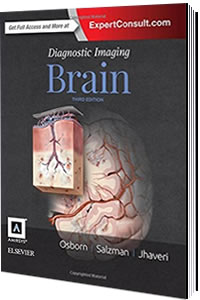 İngilizce TıpElsevier97803233775469780323377546Diagnostic Imaging