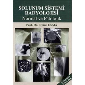solunum-sistemi-radyolojisi-normal-ve-patolojikb37be55a4edee59fa4ac47cc91e5b85a.jpg