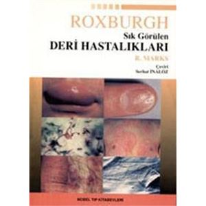 roxburgh-sik-gorulen-deri-hastaliklari-serhat-inalozef767f360b7346aa16e0396ed35c682d.jpg