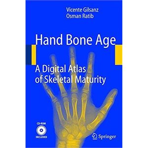 hand-bone-age-a-digital-atlas-of-skeletal-maturity375a6869893180e09b7a292611318949.jpg