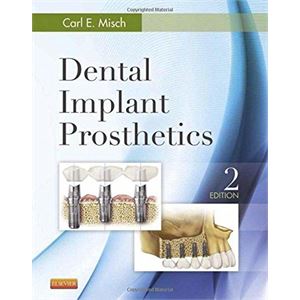 dental-implant-prosthetics97b75dc913bd6c5e3dbabc8040187ab0.jpg