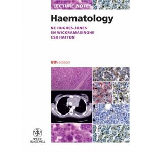 lecture-notes-haematology5158e06a5505e6591d63ef83e137136f.jpg