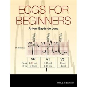 ecgs-for-beginners8f556d6a12894e4c0805431ed20605bb.jpg