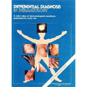 differential-diagnosis-in-dermatologyf4186406ef3e984fca71d9807bea8708.jpg