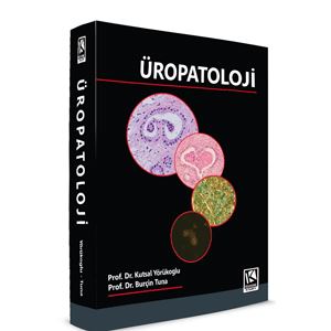 uropatoloji6ae125648e50122fe5f4dc0a3e07563b.gif