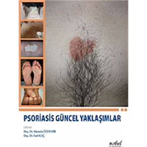 psoriasis-guncel-yaklasimlar-mustafa-ozdemir-erol-koccfb90c999fb554033b6388c4dd02b7c9.jpg