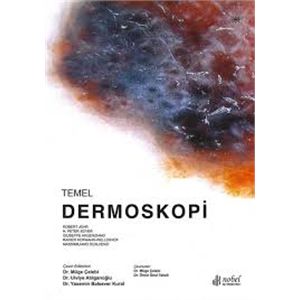 temel-dermoskopi-muge-celebi-omur-unal-tekeli2787d60e335b326ae94afee7499c30c9.jpg