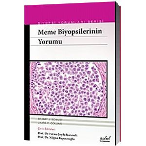 nobel-tip-meme-biyopsilerinin-yorumu-biyopsi-yorumlari-serisi8b50884ca06a99e1579e7eff9a50a312.jpg