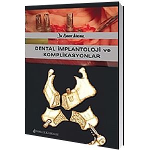 dental-implantoloji-ve-komplikasyonlar-korkut-aldemirb67babae2b99a70cbf13dfe50604a3a8.jpg