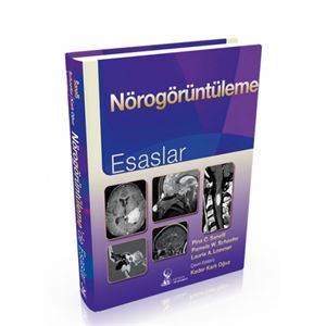 norogoruntuleme-kapak-500x515-1533719314.jpg