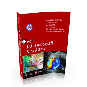 acil-ultrasonografi-kapak-500x515-1533720319.jpg