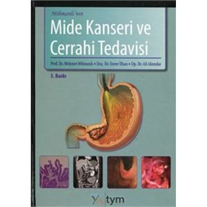mide-kanseri-1541514539.jpg