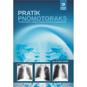 pratik-pnomotoraks1b169d06b7fdd676326528af1a8090ad.jpg