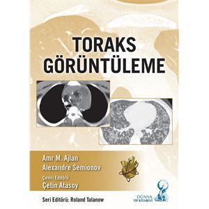 toraks-goruntuleme0ec2f63bb3f7c3611d28e136d5e21b69.jpg