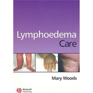 lymphoedema-careb87b12d10e8986b8305b1f52bd6365df.jpg