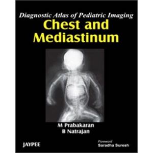 chest-and-mediastinumdd0c4583d51064ccc31fc6fd398233a5.jpg