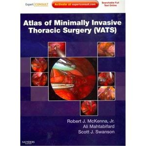 atlas-of-minimally-invasive-thoracic-surgery-vatsa4465eb7b327ba7edd9a441338d505b0.jpg