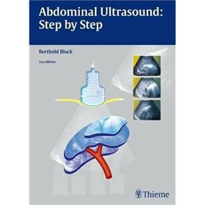 abdominal-ultrasoundbc448ae933e3d5c7f61dc2b57908edb2.jpg