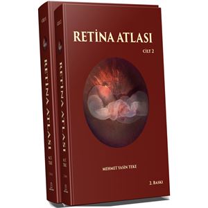 retin1aa1-1578468494.png
