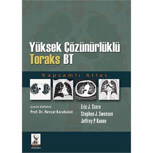 yuksek-cozunurluklu-toraks-bt2370bcf6aef05815e4290c75f6ac1b43.jpg