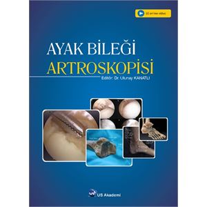 ayak-bilegi-artroskopisiaee572139c5ef292545a5cef9721d906.jpg