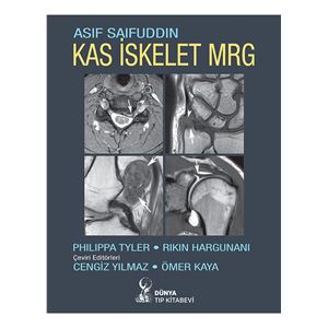 kas-iskelet-mrg25bf057df420a91be20ba72c50c42821.jpg