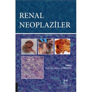 renal-neoplaziler89d7d3aaadb566eca0e0973845b427bb.jpg