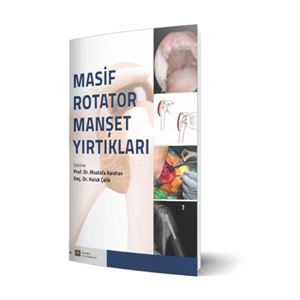 masif-rotator-manset-yirtiklaria4b67cbdcc54557dc656917c573268b8.jpg
