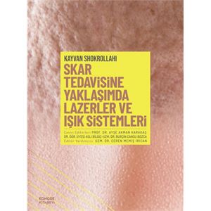 skar-yeni6103beb6ecc12-1631609998.jpg