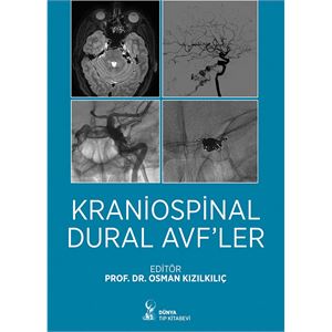 kraniospinal-dural-avfler9cabeb077e9247572e2c3228d4c0e176.jpg