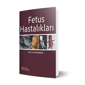 fetus-hastaliklari1beea89643c051ea93855610064a3c57.jpg