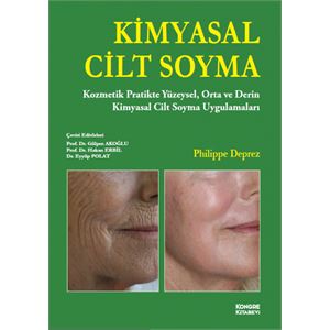 kimyasal-cilt-soyma5c5aa8f4b66ae2d52723b25eba5fec4f.png