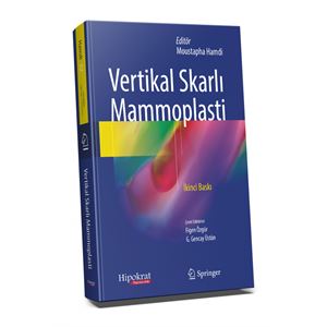 vertikal-skar-1659510369.png