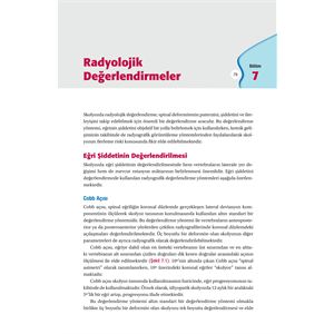skolyozdaftrbaski_01.jpg